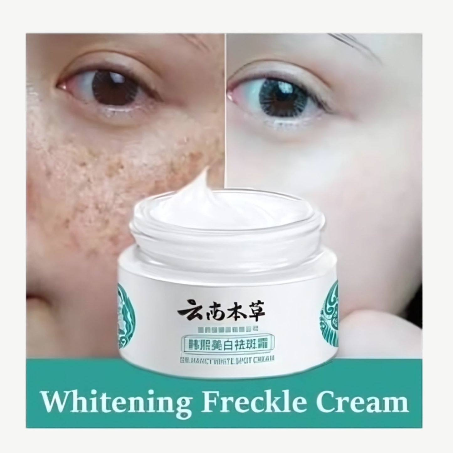 Japanese Melasma Cream (Dr. Hancy White Spot) 20g