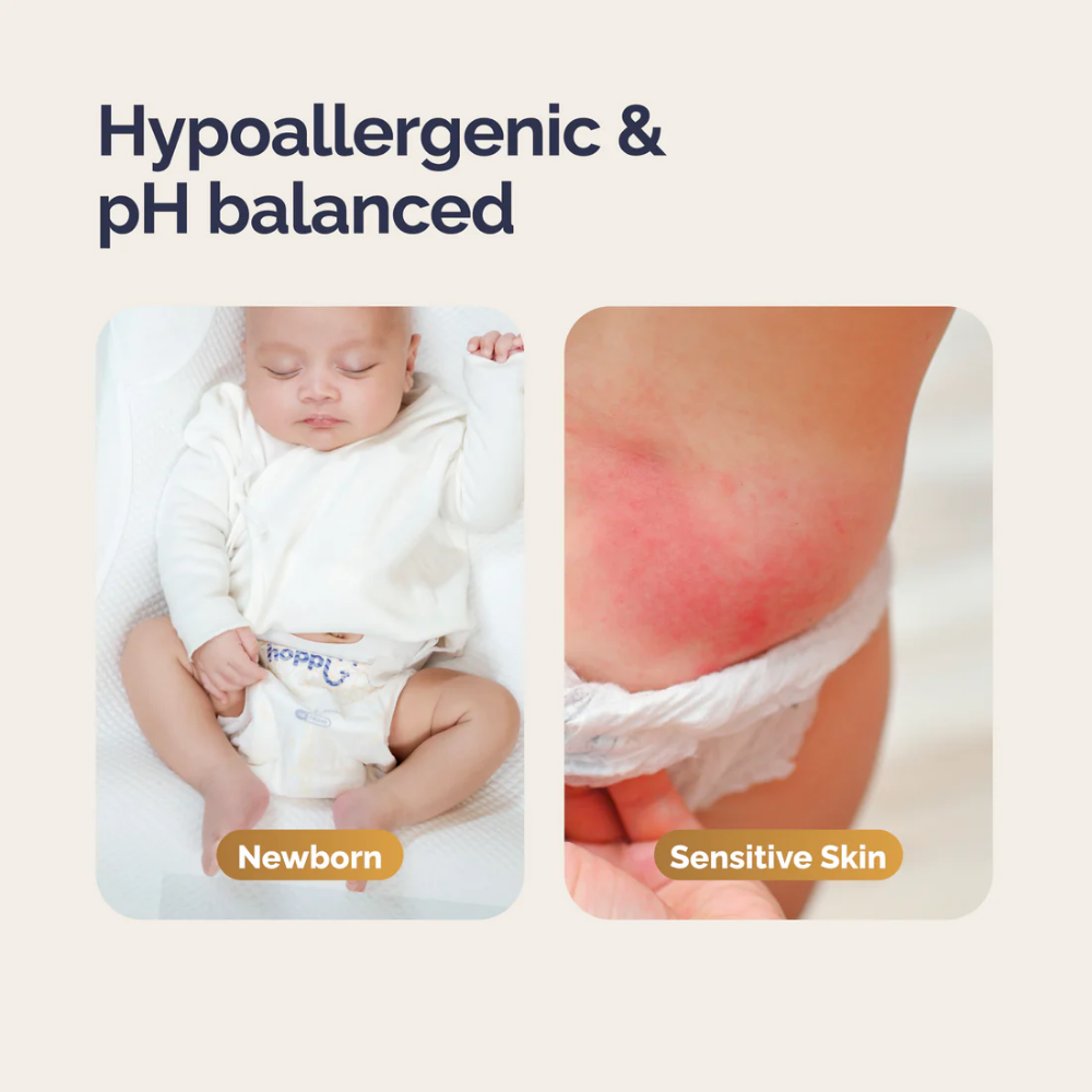Hoppi RoyalDream Baby Diaper Tape | Hypoallergenic Babies